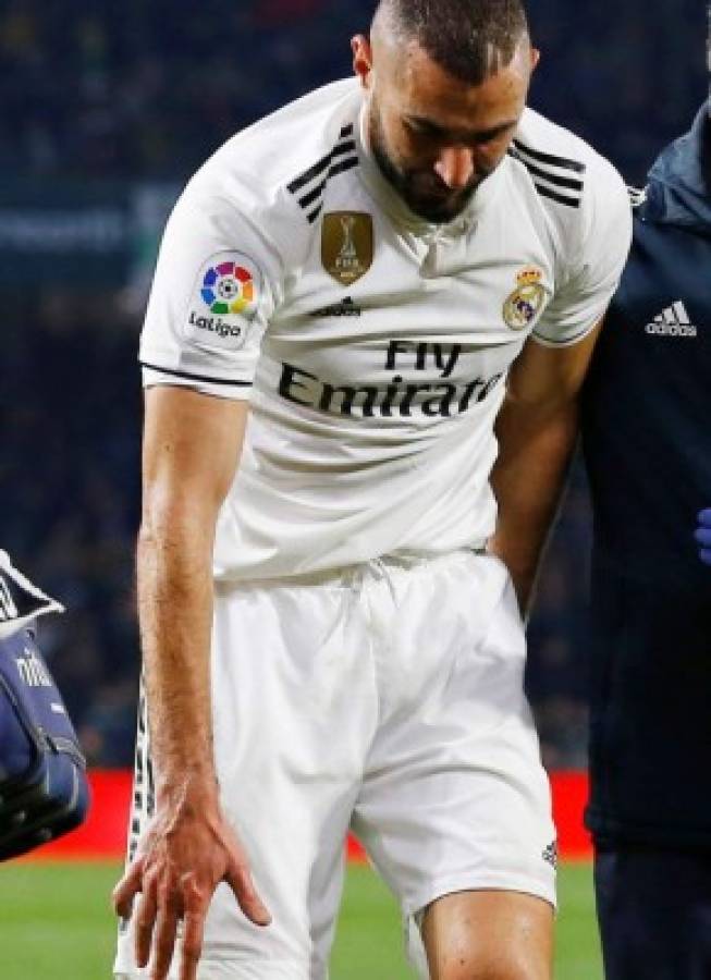 Benzema y la misteriosa lesión en su mano: Así tiene el dedo y aclara por qué no se opera