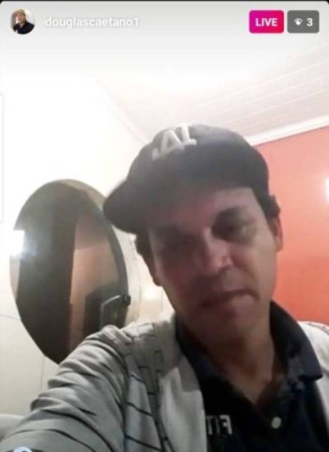 Douglas Caetano aparece en un Live de Instagram y sorprende con su maltratada apariencia