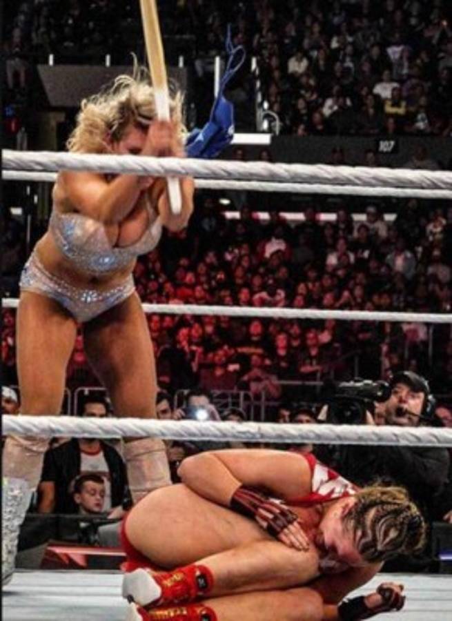 Moretones y heridas: Las fotos actualizadas de cómo quedó Ronda Rousey una semana depués de la paliza