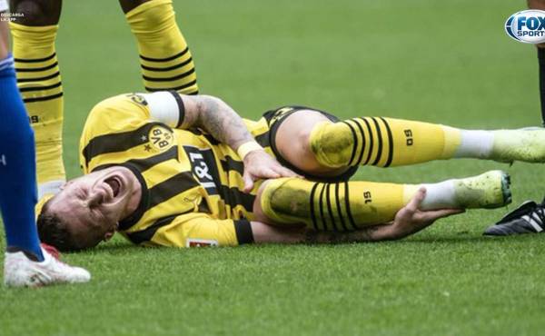Durísimo: entre lágrimas, Marco Reus salió lesionado con el Dortmund y peligra a perderse otro Mundial con Alemania