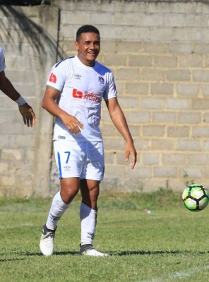 Uno a Uno del Olimpia subcampeón del torneo Apertura de Liga Nacional