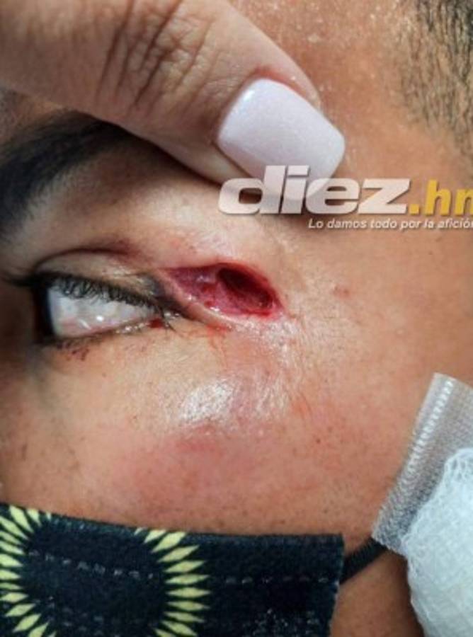 Lo que no viste en TV en la jornada 9: bellezas, beso apasionado de Pereira ¡y graves heridas a dos jugadores!