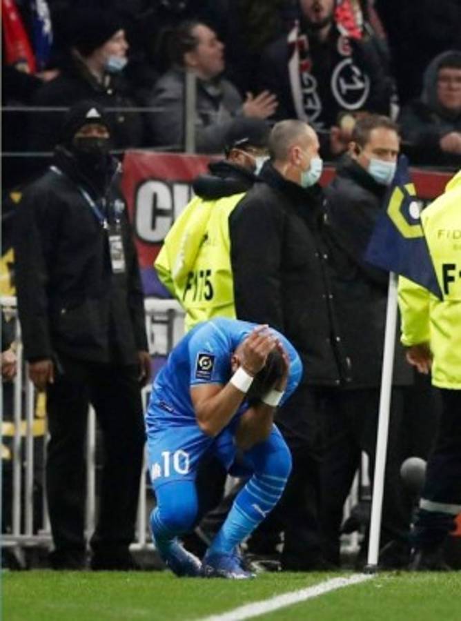 Fotos: Así fue la agresión que sufrió Payet en la Liga de Francia; ¡botellazo en la cabeza!