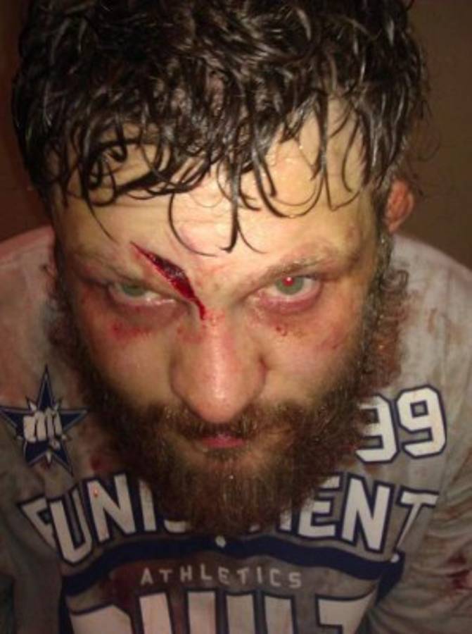 Fotos: Los golpes más espeluznantes en la UFC