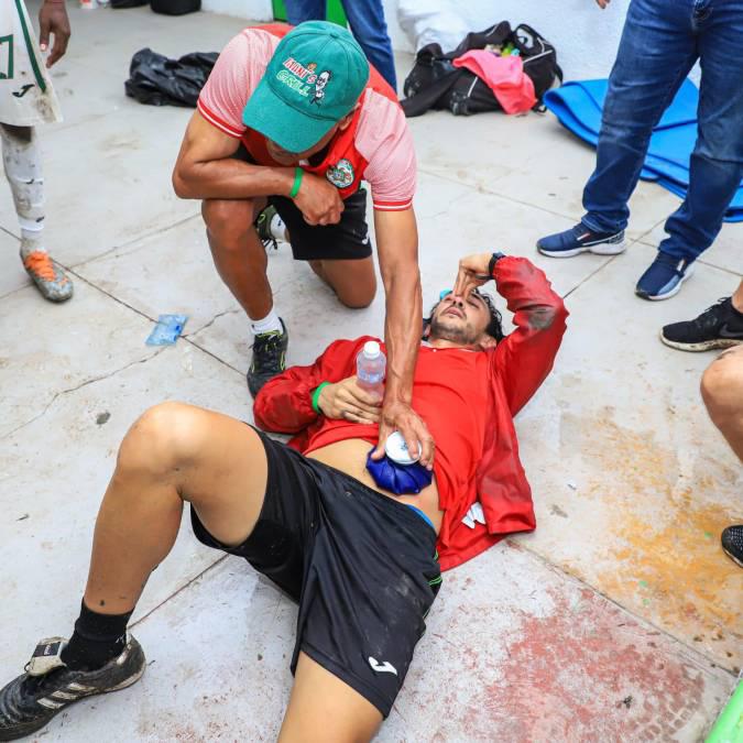 Así quedó Flavio Chagas tras la pelea en el Potros - Marathón.