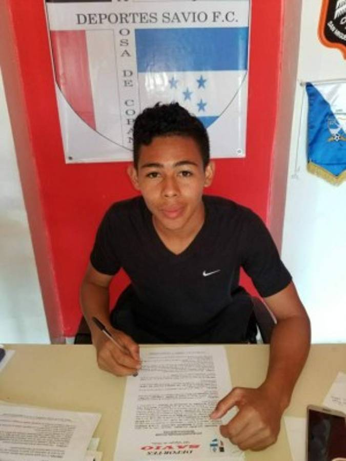 FICHAJES: Liga de Ascenso se nutre de colombianos y un mexicano