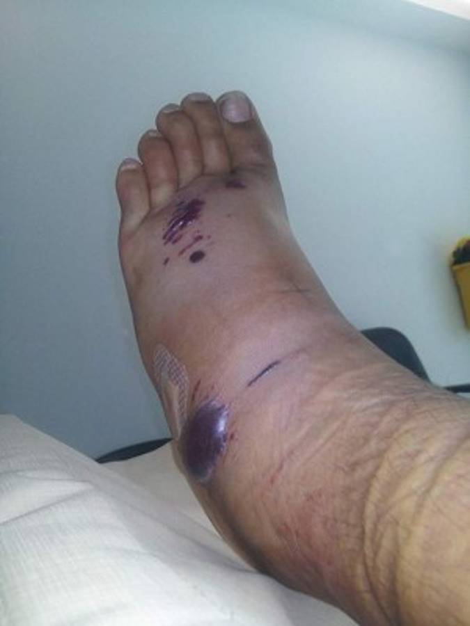 27 fotos que demuestran que Australia es un país 'aterrador' para vivir