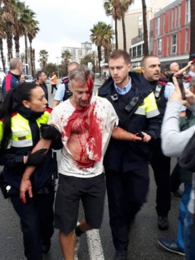 ¡Decenas de heridos! Las imágenes del choque de policía con catalanes a favor de independencia