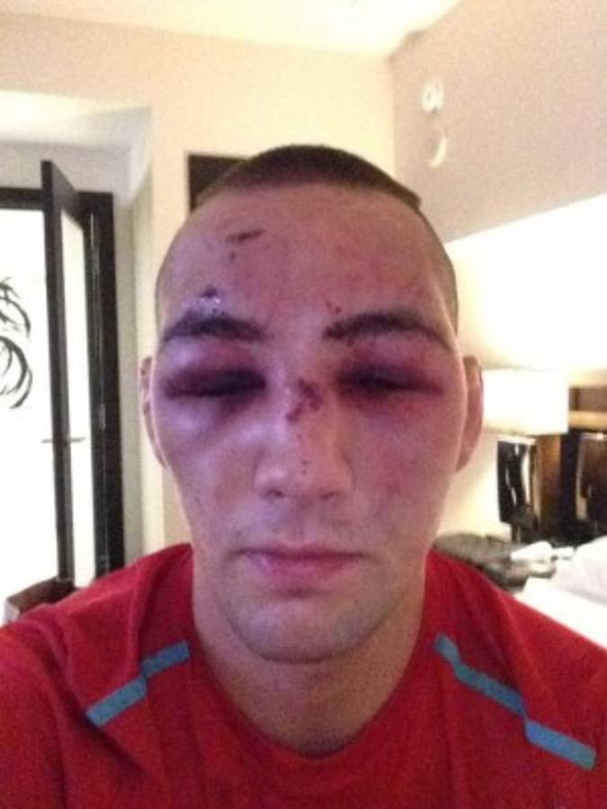 Fotos: Los golpes más espeluznantes en la UFC