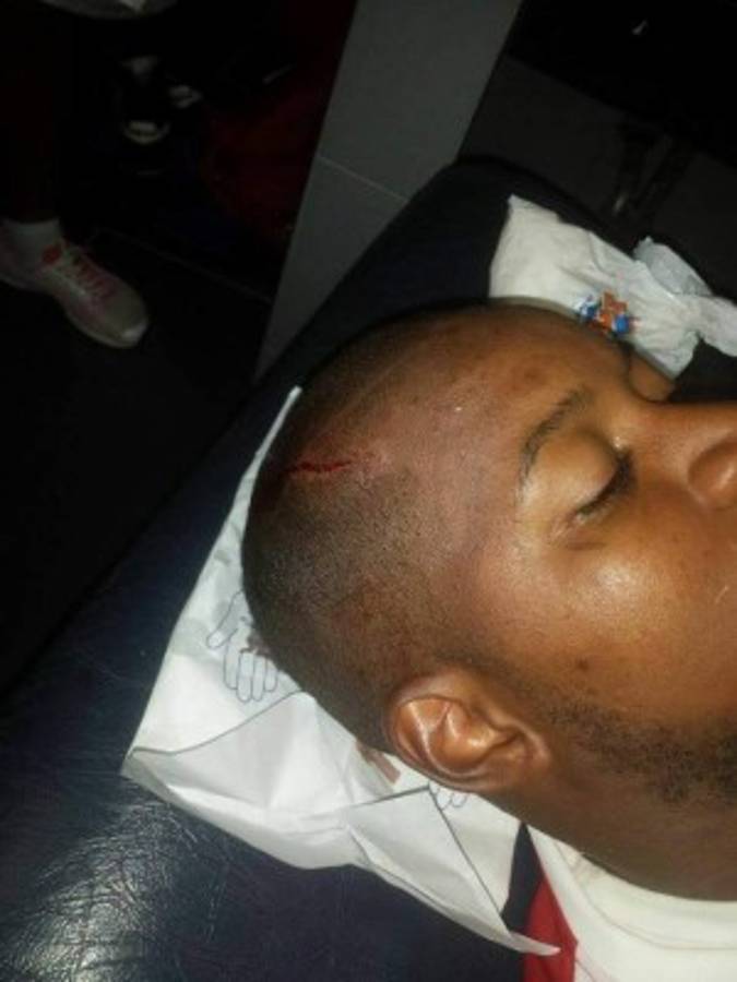 FOTOS: Así quedaron Yul Arzú y Portigliatti tras el Motagua-Juticalpa