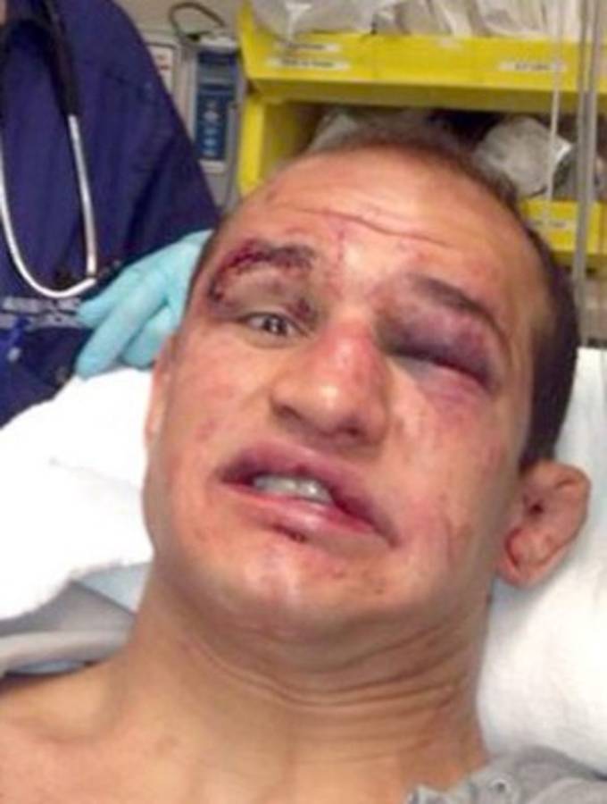 Fotos: Los golpes más espeluznantes en la UFC