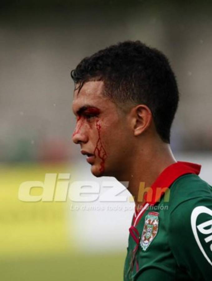 Las imágenes que no viste en televisión del Marathón-Motagua