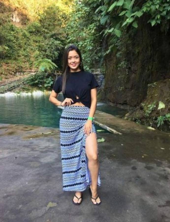 Andrea Núñez, la muñequita odontóloga que se robó el corazón de Ángel Tejeda