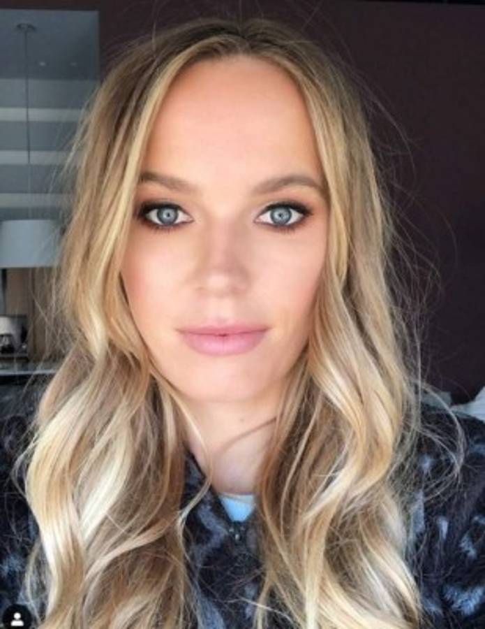 Caroline Wozniacki, la sensual tenista que sufre una enfermedad degenerativa, anuncia su retiro