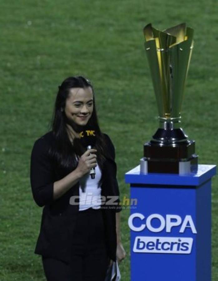 No lo viste en TV: La 'barbie' que apoyó a Real España, el duro lamento de Klusener y así captaron al Bolillo Gómez