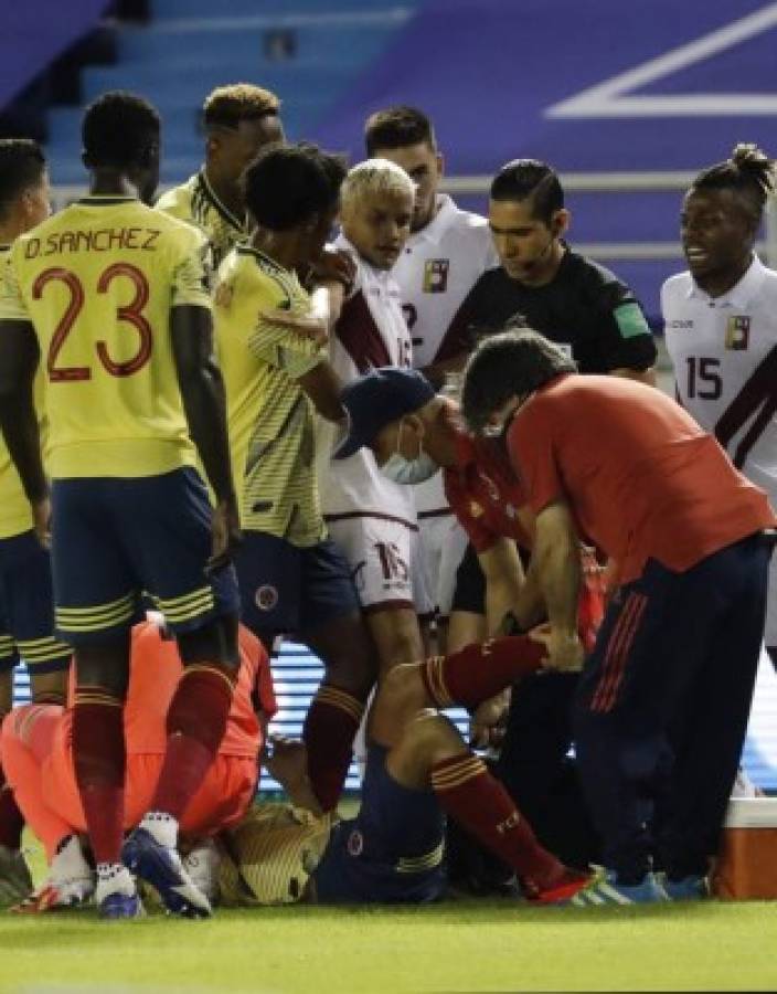 Dolorosas imágenes: así quedó el tobillo de Santiago Arias tras sufrir terrible lesión en el Colombia-Venezuela