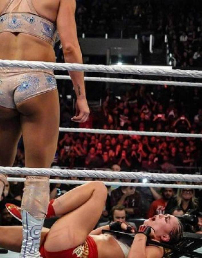 Ronda Rousey muestra sus impactantes lesiones tras la paliza en la WWE