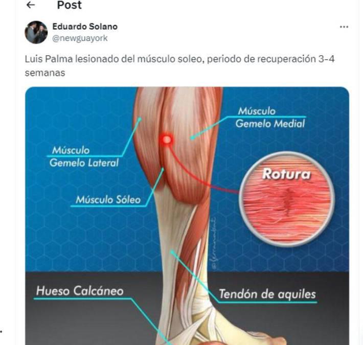 ”Si no se logra pasar ante Honduras, Gustavo Alfaro debe renunciar”, Prensa Costarricense mete presión tras las bajas de La H
