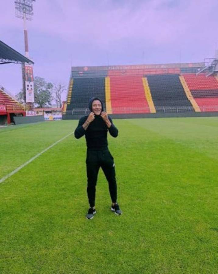 La brutal transformación de Luis Garrido tras la espantosa lesión