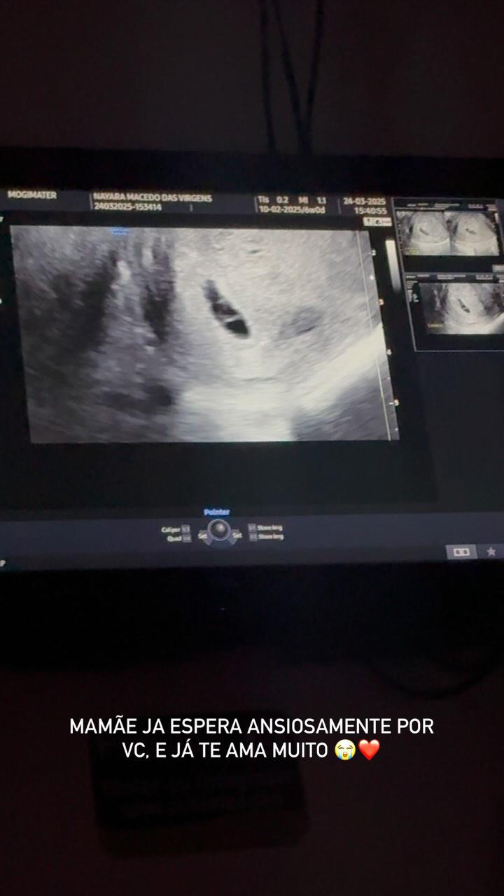 Polémica: Modelo asegura estar embarazada de Neymar tras encuentro íntimo con el brasileño: Todos se burlan de mí