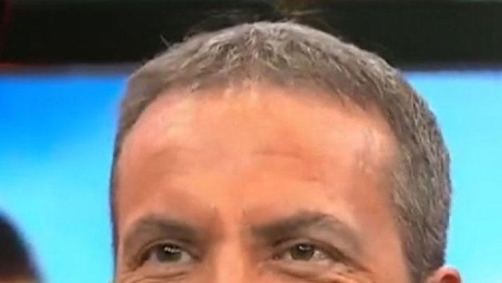 Se inyectó bótox y el resultado es llamativo: Así quedó el rostro de Cristóbal Soria luego de una operación estética