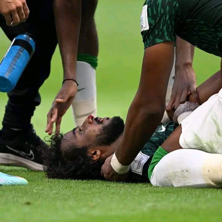 ¡Impactante momento! Confirman alcance de la lesión de Al Shahrani, jugador de Arabia Saudí tras vencer a Argentina