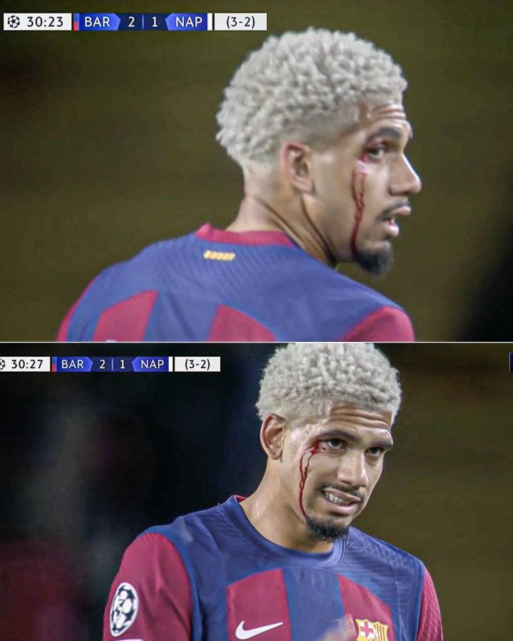 La eufórica celebración del Barcelona y Xavi por volver a cuartos de la Champions y el corte que sufrió Ronald Araújo