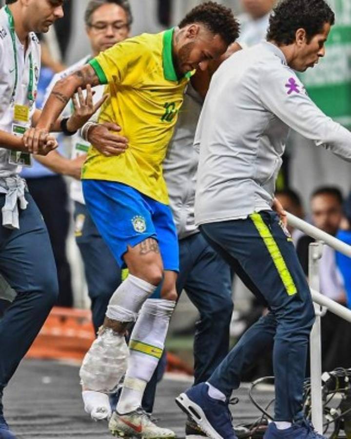 FOTOS: Así fue el drama que vivió Neymar tras su ruptura de ligamentos en el tobillo