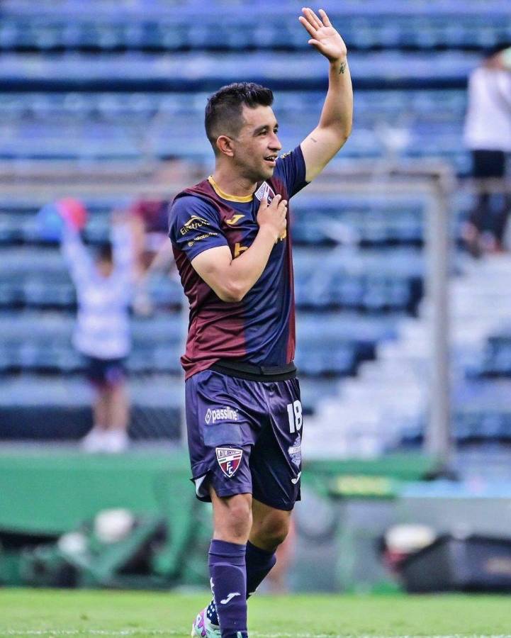 Escalofriante lesión del mexicano Hobbit Bermúdez: así quedó la pierna del jugador y la bronca con el culpable