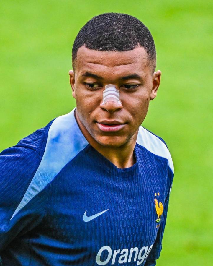 Las primeras fotos de Kylian Mbappé tras fracturarse la nariz en la Eurocopa 2024: el anuncio de su entrenador