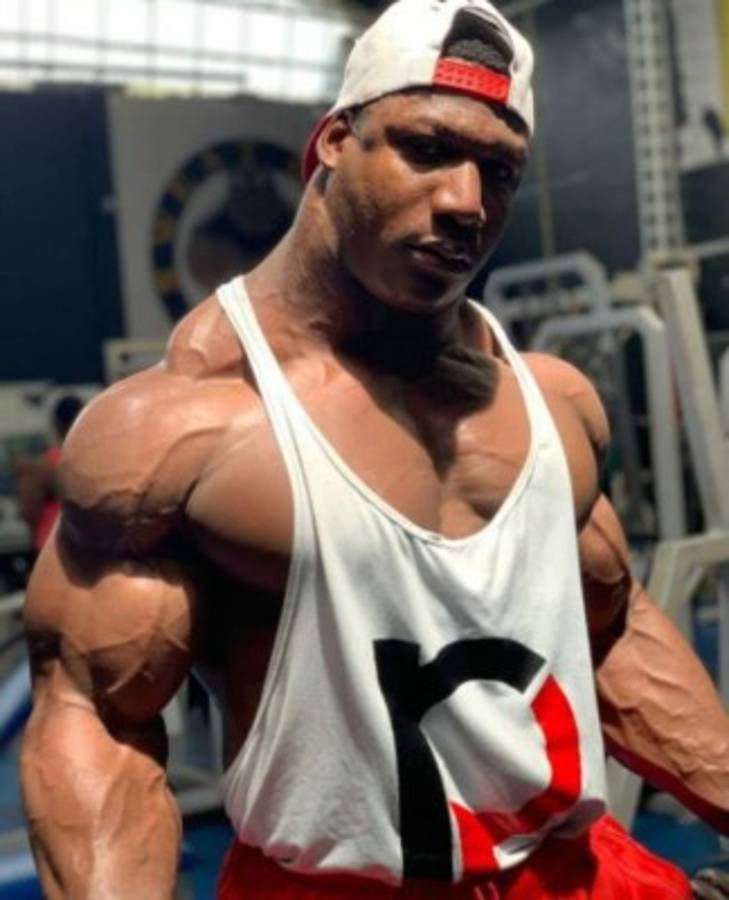 Increíble: Así es Rubiel Mosquera, el hombre con el cuello más grande y