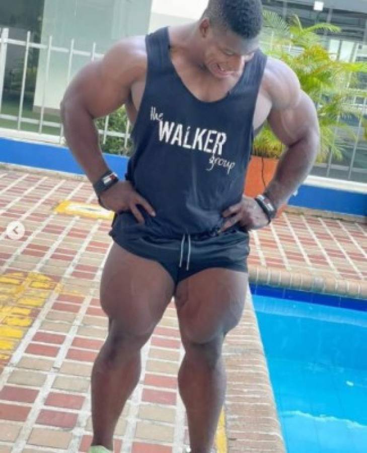 Increíble: Así es Rubiel Mosquera, el hombre con el cuello más grande y