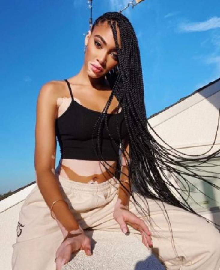 Winnie Harlow, preciosa modelo que padece de vitiligo, es 'cazada' con famoso deportista