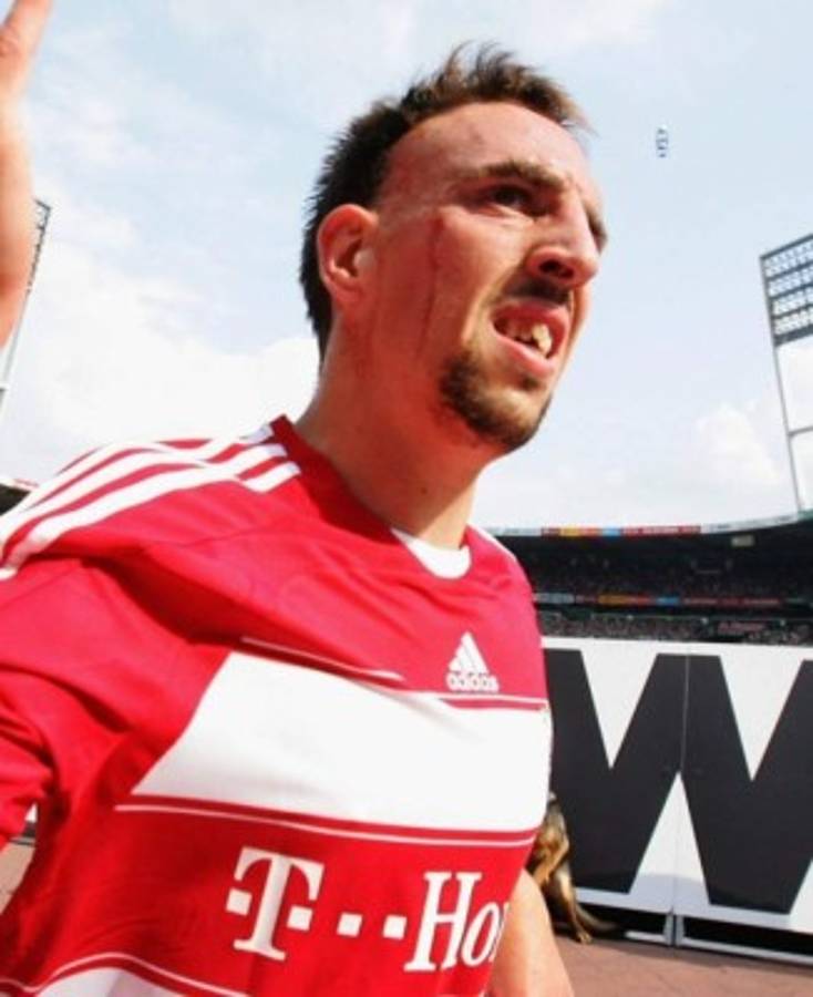 Por Halloween: Los jugadores más feos en el mundo del fútbol   