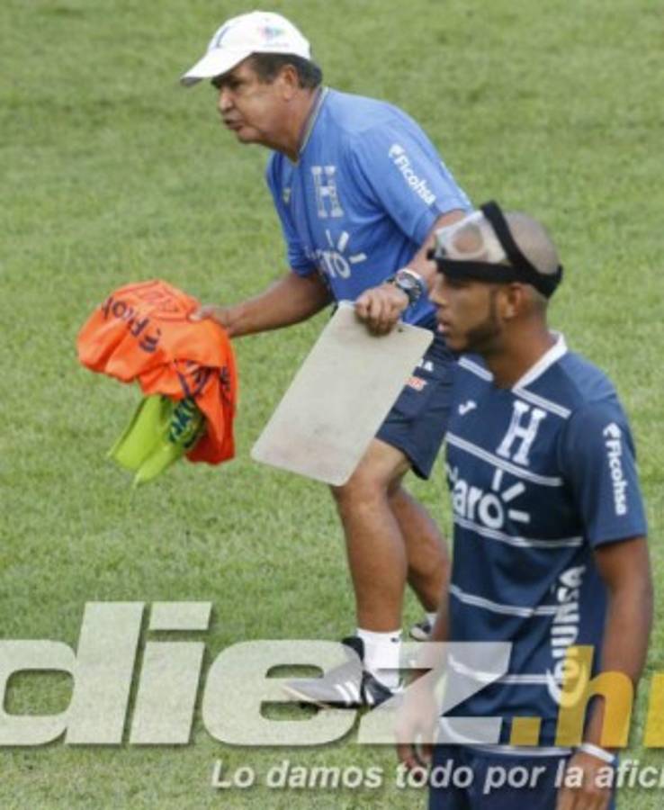 ¡Ufff! Eddie Hernández se quita la máscara y así se ve su ojo; ambiente en Honduras se calienta