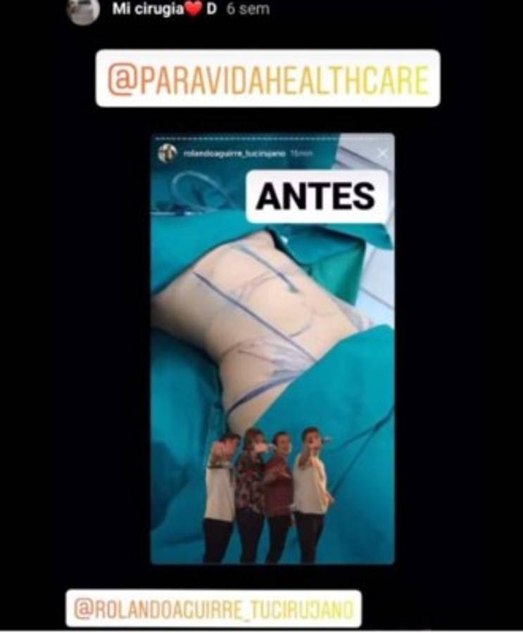 El antes y el después de la guapa Alejandra Rubio tras las cirugías plásticas