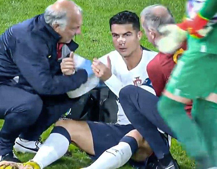Los checos le dieron con todo: Cristiano Ronaldo sufre durísimo golpe que lo dejó tendido en el suelo y sangrando