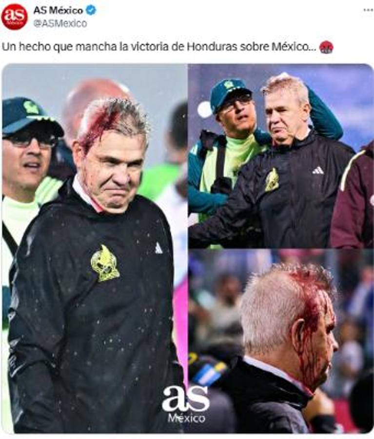Prensa de México tras derrota y agresión a Javier Aguirre: “Perdimos, pero a Honduras hay que descalificarla”