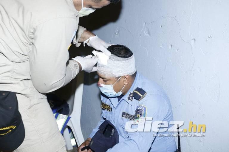 Joven cayó de espaldas al suelo: las otras fotos que no viste del zafarrancho del Real España-Marathón ¡varios policías heridos!