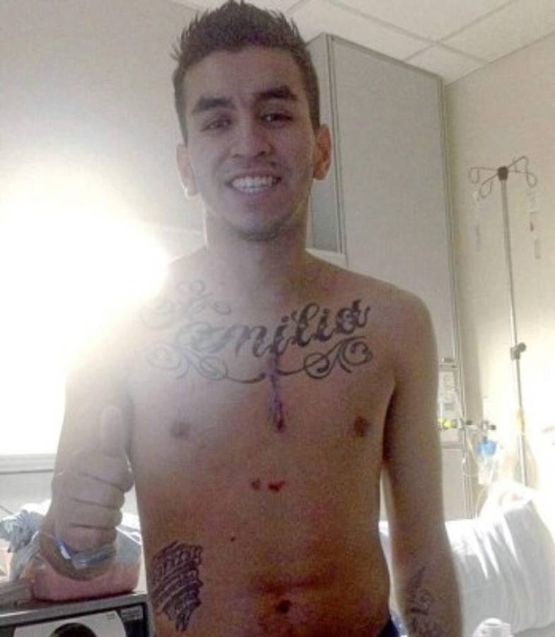 Escalofriantes: Las cicatrices más impactantes que han sufrido futbolistas y otros deportistas