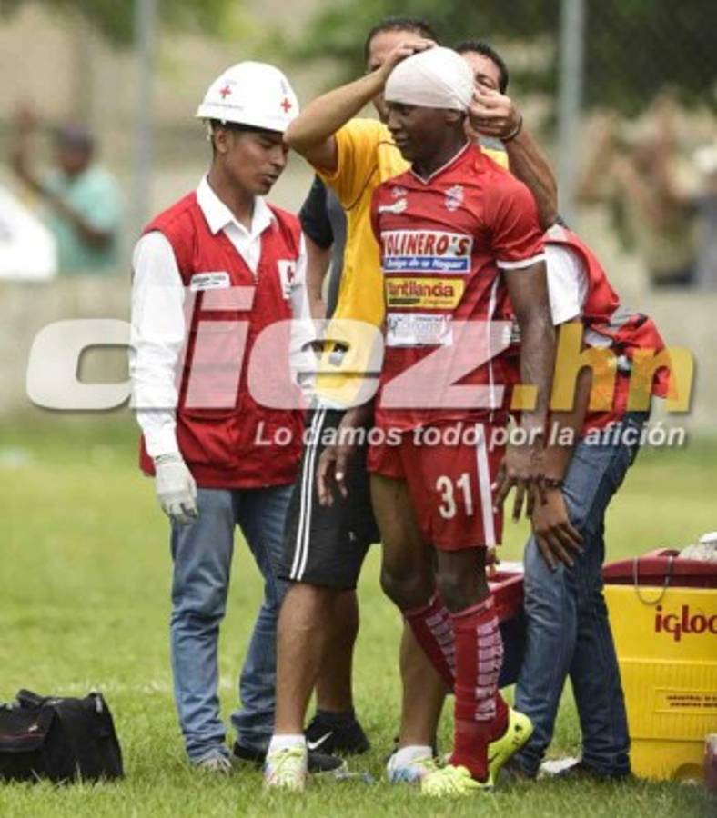 Las imágenes que no se vieron en televisión de la fecha 8 en Honduras