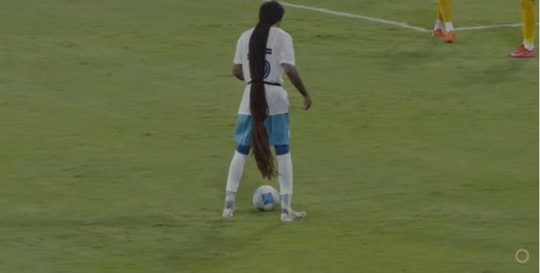 Concacaf: las insólitas rojas que provocó jugador de 1.5 metros por sus trenzas