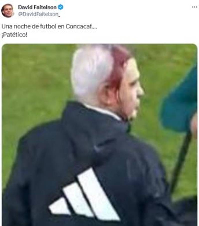 Prensa de México tras derrota y agresión a Javier Aguirre: “Perdimos, pero a Honduras hay que descalificarla”