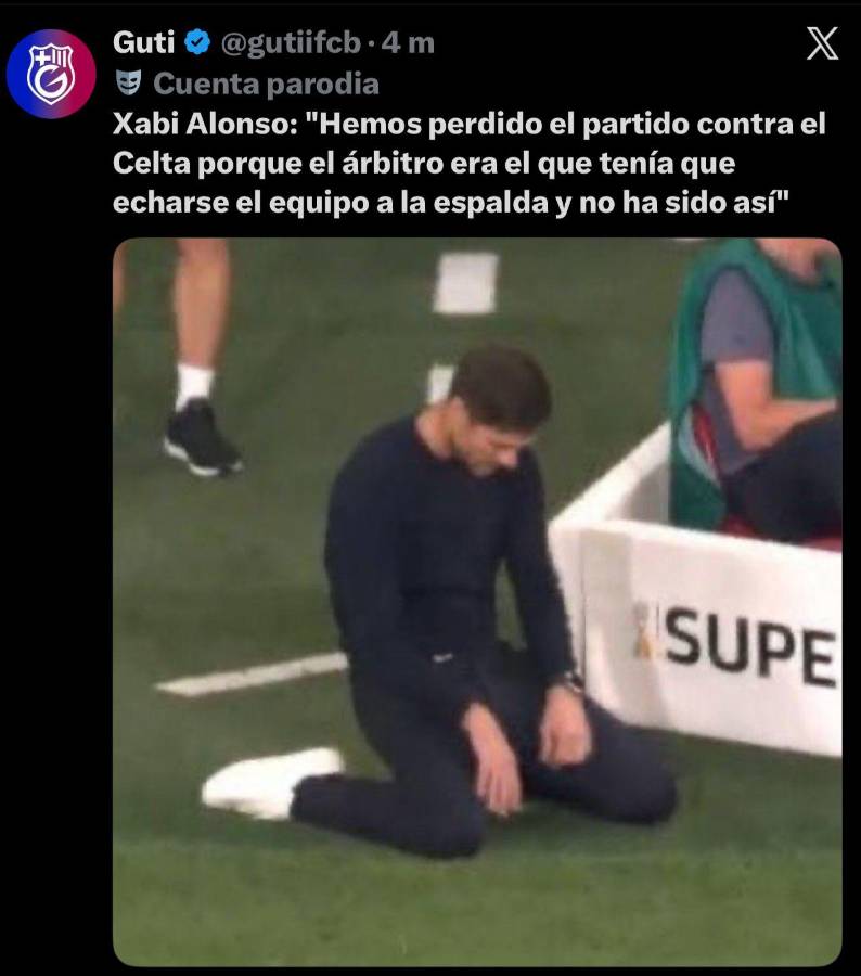 Se burlan de Xabi Alonso: los mejores memes que dejó la derrota del Real Madrid ante el Celta de Vigo por LaLiga