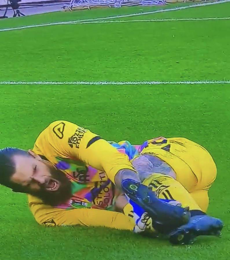 No apto para sensibles: La terrible lesión de tobillo que sufrió jugador de Polonia que se perderá el Mundial de Qatar