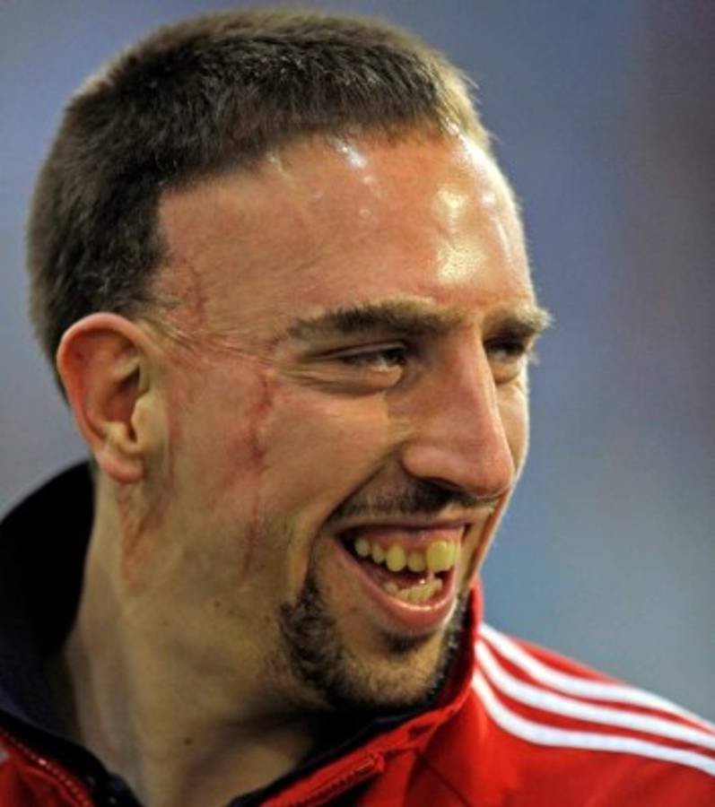 Los futbolistas más feos del planeta