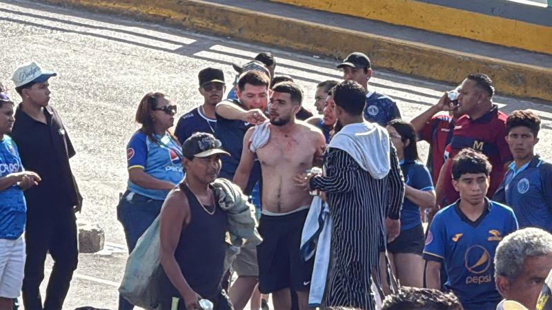 FOTOS: heridos, disparos y el momento de caos que se vivió en el enfrentamiento entre barras de Motagua y Olimpia