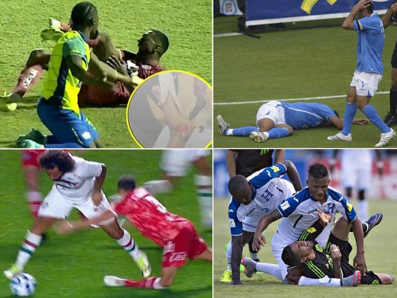 Romario da Silva, delantero de Motagua, se une a la lista de jugadores que sufrieron una terrible lesión en su carrera.