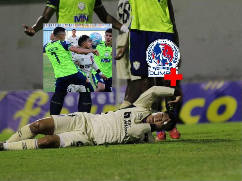 Olimpia pierde a Michaell Chirinos para el duelo ante Saprissa de Costa Rica.