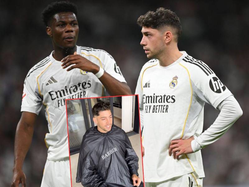 La tremenda cicatriz en la cabeza de Fede Valverde tras su pelea con Tchouaméni